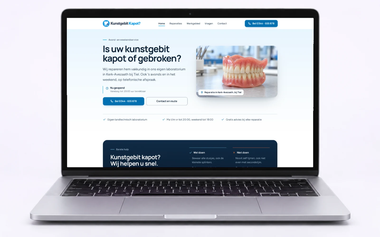 Kunstgebit Kapot, zoals het eruitziet in gebruik